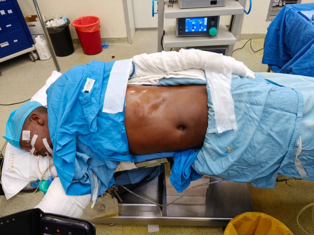 Patient Prepped for Nephrectomy