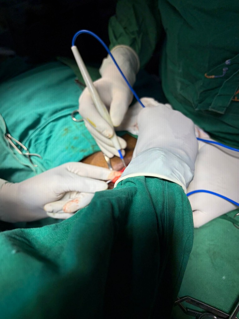 Precision Surgical Intervention